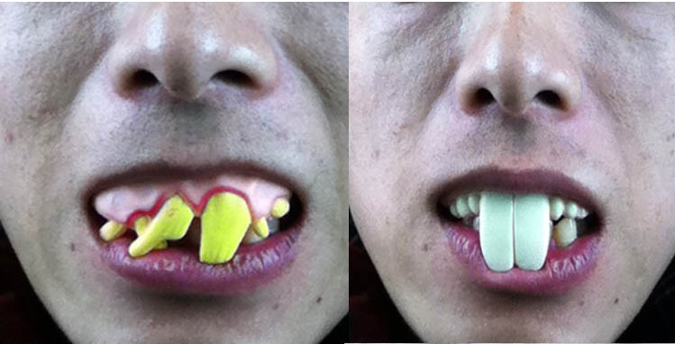 Dientes para Halloween