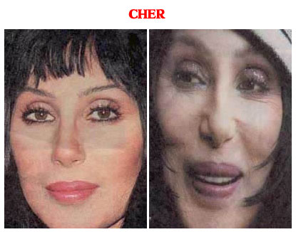 Cher