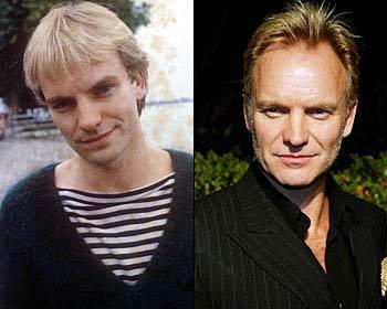 Sting